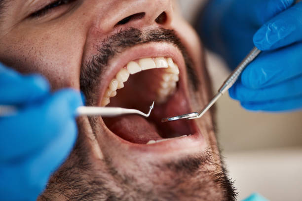Best Broken or Cracked Tooth Emergency Dentist in Audubon, NJ